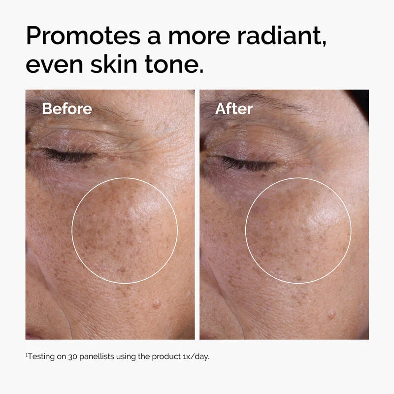 The Ordinary – Tonique Exfoliant à l’Acide Glycolique 7%