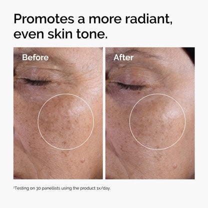 The Ordinary – Tonique Exfoliant à l’Acide Glycolique 7%